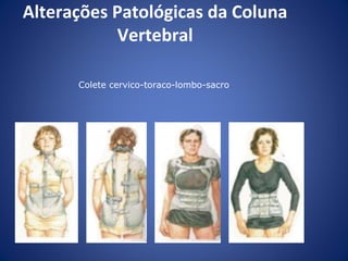 Alterações Patológicas da Coluna
Vertebral
Colete cervico-toraco-lombo-sacro

 