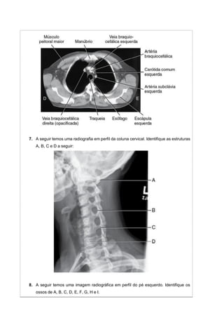 7. A seguir temos uma radiografia em perfil da coluna cervical. Identifique as estruturas
A, B, C e D a seguir:
8. A seguir temos uma imagem radiográfica em perfil do pé esquerdo. Identifique os
ossos de A, B, C, D, E, F, G, H e I.
 