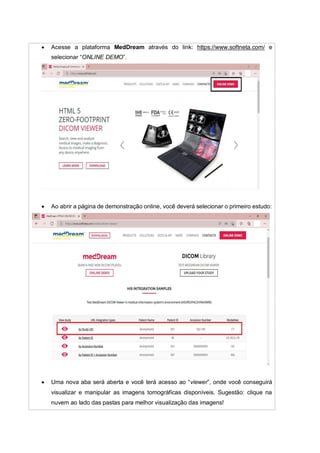  Acesse a plataforma MedDream através do link: https://www.softneta.com/ e
selecionar “ONLINE DEMO”.
 Ao abrir a página de demonstração online, você deverá selecionar o primeiro estudo:
 Uma nova aba será aberta e você terá acesso ao “viewer”, onde você conseguirá
visualizar e manipular as imagens tomográficas disponíveis. Sugestão: clique na
nuvem ao lado das pastas para melhor visualização das imagens!
 