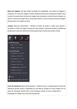 Barra de rolagem: No lado direito da janela de visualização, uma barra de rolagem é
mostrada. Um cursor de rolagem é rolado respectivamente para a posição da imagem ativa
na série. Na parte inferior da barra de rolagem são mostrados o número total de imagens na
série e o número da imagem ativa. Você pode arrastar o cursor ao longo da barra de rolagem
para percorrer as imagens da série.
Janelas: Barra de ferramentas > Window. O botão de janela é usado para ajustar o
contraste e o brilho da imagem (valores de nível e janela). Você pode escolher as diferentes
janelas para evidenciar diferentes tecidos (janela óssea, janela para tecidos moles).
Linha de referência: Barra de ferramentas > Reference lines. A sobreposição de linhas de
referência permite indicar a localização de uma fatia de imagem em outra imagem de um
plano de interseção. Dessa forma, você consegue verificar no scout, exatamente a
localização da imagem que você está visualizando.
 