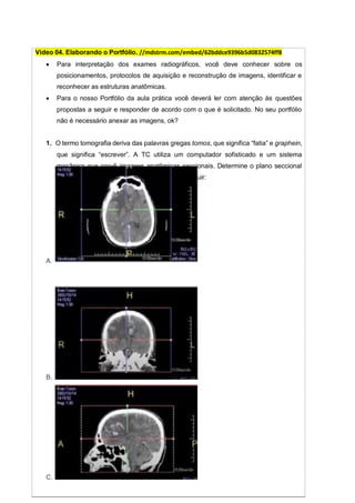 Vídeo 04. Elaborando o Portfólio. //mdstrm.com/embed/62bddce9396b5d0832574ff8
 Para interpretação dos exames radiográficos, você deve conhecer sobre os
posicionamentos, protocolos de aquisição e reconstrução de imagens, identificar e
reconhecer as estruturas anatômicas.
 Para o nosso Portfólio da aula prática você deverá ler com atenção às questões
propostas a seguir e responder de acordo com o que é solicitado. No seu portfólio
não é necessário anexar as imagens, ok?
1. O termo tomografia deriva das palavras gregas tomos, que significa “fatia” e graphein,
que significa “escrever”. A TC utiliza um computador sofisticado e um sistema
mecânico que provê imagens anatômicas seccionais. Determine o plano seccional
demonstrado para cada uma das imagens a seguir:
A.
B.
C.
 