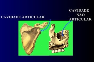 CAVIDADE ARTICULAR CAVIDADE NÃO ARTICULAR 