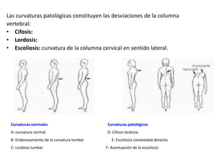Las curvaturas patológicas constituyen las desviaciones de la columna
vertebral:
• Cifosis:
• Lordosis:
• Escoliosis: curvatura de la columna cervical en sentido lateral.
Curvaturas normales Curvaturas patológicas
A: curvatura normal D: Cifosis torácica
B: Enderezamiento de la curvatura lumbar E: Escoliosis convexidad derecha
C: Lordosis lumbar F: Acentuación de la escoliosis
 