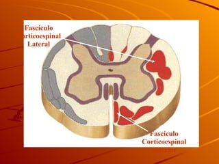 Fascículo Corticoespinal anterior Fascículo Corticoespinal Lateral 
