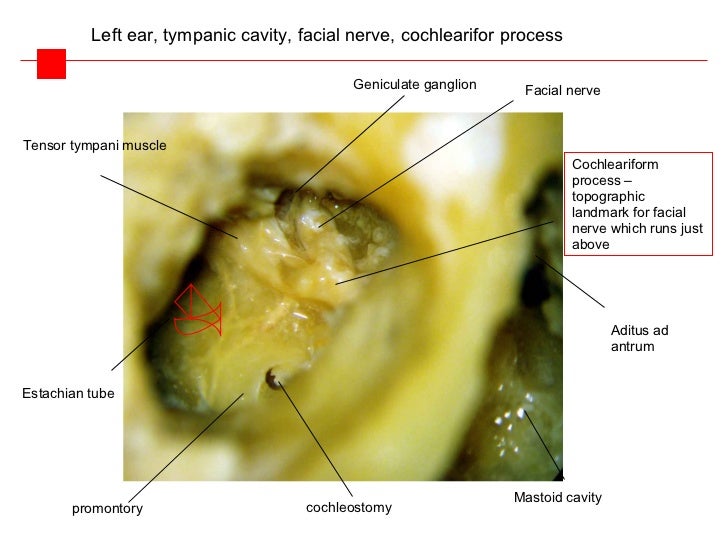 Clinical anatomy of the middle ear
