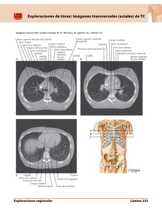 Anatomia - Netter.pdf
