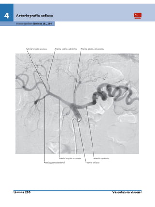 Anatomia - Netter.pdf