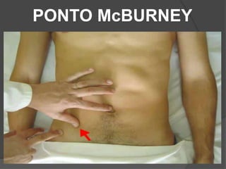 PONTO McBURNEY
 