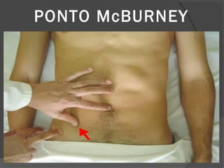 PONTO McBURNEY
 