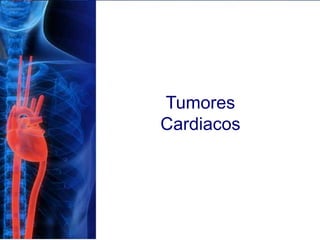 Tumores
Cardiacos
 