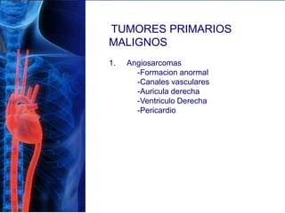 TUMORES PRIMARIOS
MALIGNOS
1. Angiosarcomas
-Formacion anormal
-Canales vasculares
-Auricula derecha
-Ventriculo Derecha
-Pericardio
 