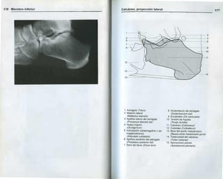 Romanulus Radiopaedia Anatomia radiologica | PDF
