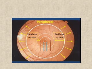 Parafovea   Perifovea
 0.5 mm      1.5 mm
 