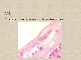 MLI
Separa fibras nerviosas de elementos vitreos
 