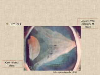 Cara externa:
Límites                                      coroides: M
                                                 Bruch




Cara interna:
   vitreo

                Lab. Anatomia ocular - INO
 