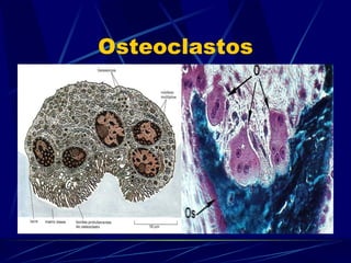 Osteoclastos 