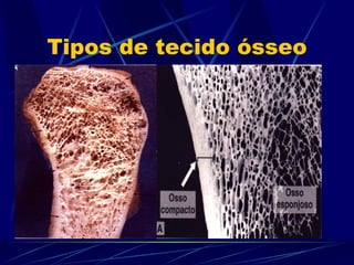 Tipos de tecido ósseo 