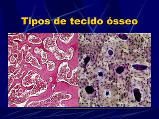 Tipos de tecido ósseo 