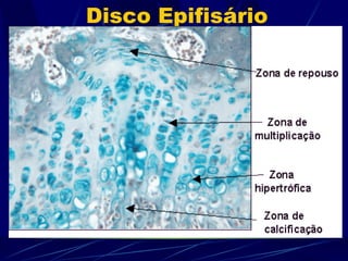 Disco Epifisário 