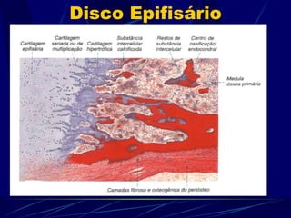 Disco Epifisário 