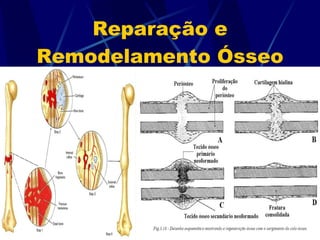 Reparação e Remodelamento Ósseo 