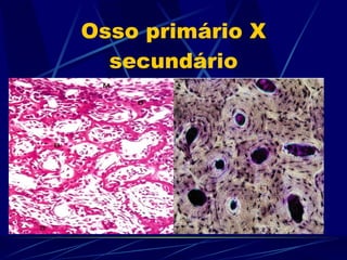 Osso primário X secundário 
