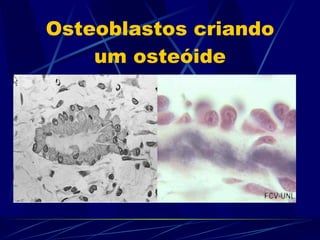 Osteoblastos criando um osteóide 