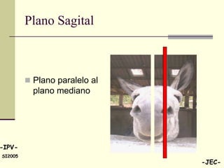 Plano Sagital



          Plano paralelo al
           plano mediano




-IPV-
SI2005
                               -JEC-
 