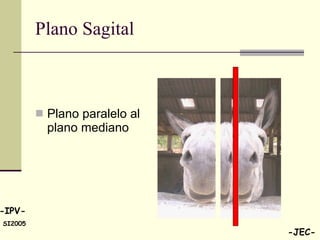 Plano Sagital Plano paralelo al plano mediano  