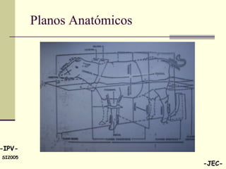 Planos Anatómicos 