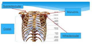 Supraclavicular.
Infraclavicular
Manubrio.
Costal.
 