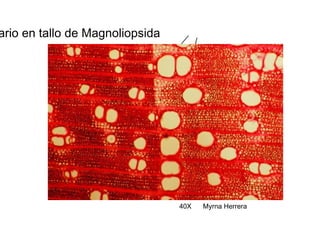 Xilema secundario en tallo de Magnoliopsida  40X  Myrna Herrera  