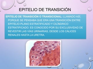 EPITELIO DE TRANSICIÓN
EPITELIO DE TRANSICIÓN O TRANSICIONAL: LLAMADO ASÍ,
PORQUE SE PENSABA QUE ERA UNA TRANSICIÓN ENTRE
EPITELIO PLANO ESTRATIFICADO Y CILÍNDRICO
ESTRATIFICADO. ES CONOCIDO POR SU EXCLUSIVIDAD DE
REVESTIR LAS VÍAS URINARIAS, DESDE LOS CÁLICES
RENALES HASTA LA URETRA.
 
