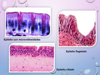 Epitelio con microvellosidades
Epitelio ciliado
Epitelio flagelado
 