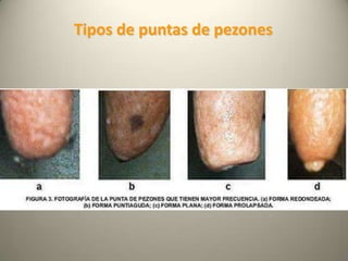 Tipos de puntas de pezones
 