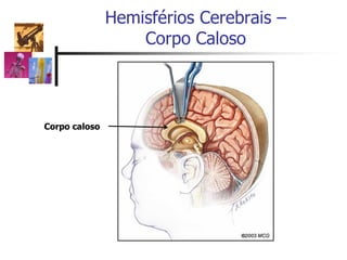 Hemisférios Cerebrais –
Corpo Caloso
Corpo caloso
 