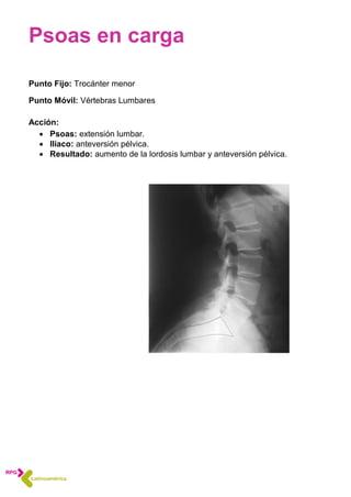 Psoas en carga
Punto Fijo: Trocánter menor
Punto Móvil: Vértebras Lumbares
Acción:
 Psoas: extensión lumbar.
 Ilíaco: anteversión pélvica.
 Resultado: aumento de la lordosis lumbar y anteversión pélvica.
 