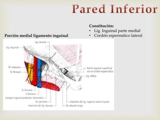 Constitución:
• Lig. Inguinal parte medial
• Cordón espermático lateralPorción medial ligamento inguinal
 