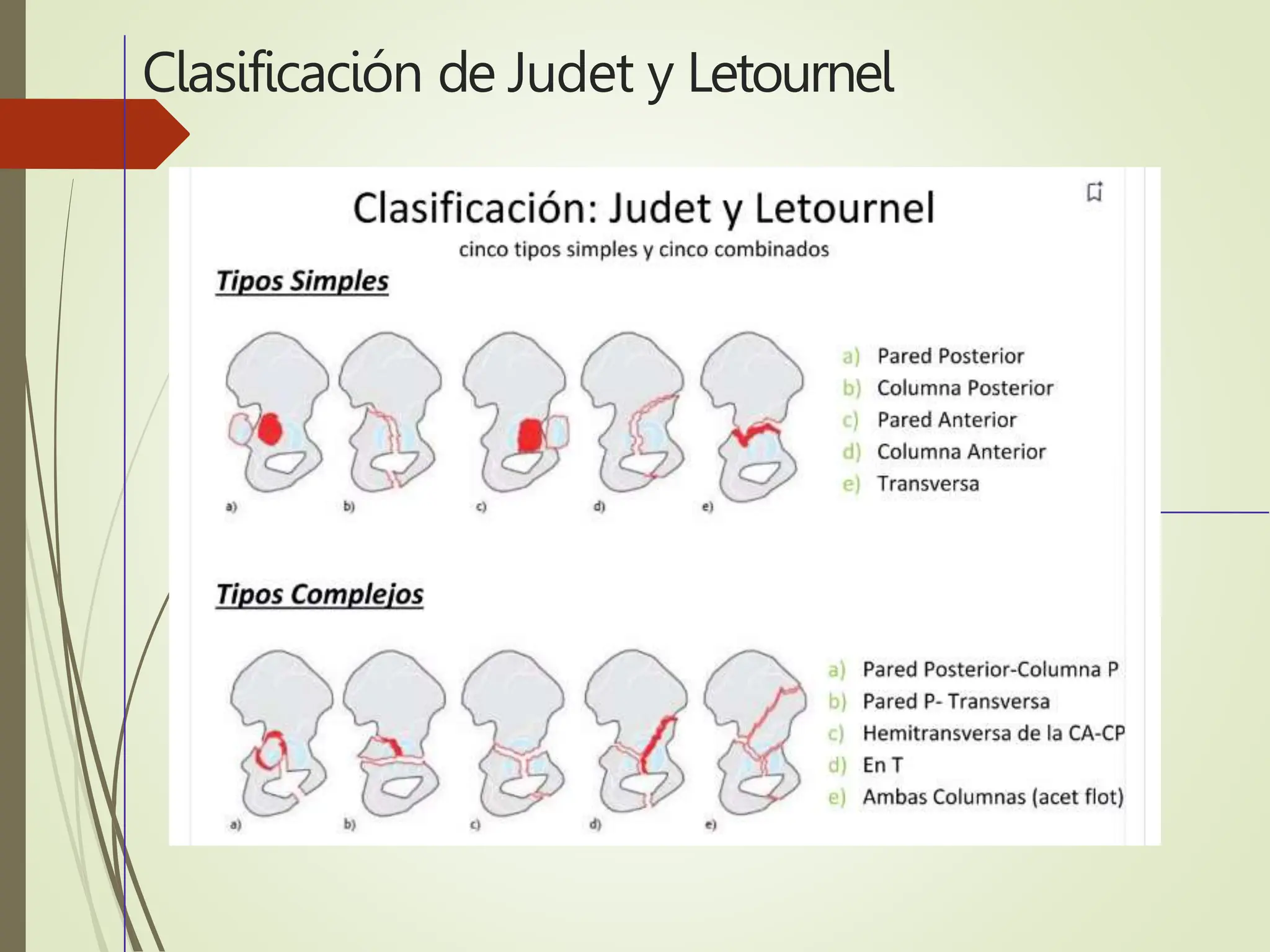 ANATOMIA ACETABULO - PSEUDOARTROSIS.pptx