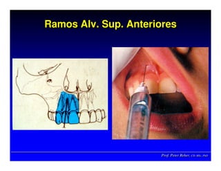 Prof. Peter Reher, CD, MSc, PhDProf. Peter Reher,Prof. Peter Reher, CD,CD, MScMSc,, PhDPhD
Ramos Alv. Sup. AnterioresRamosRamos AlvAlv.. SupSup. Anteriores. Anteriores
 