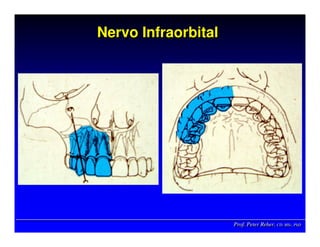 Prof. Peter Reher, CD, MSc, PhDProf. Peter Reher,Prof. Peter Reher, CD,CD, MScMSc,, PhDPhD
Nervo InfraorbitalNervo InfraorbitalNervo Infraorbital
 