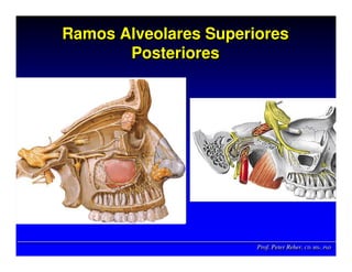 Prof. Peter Reher, CD, MSc, PhDProf. Peter Reher,Prof. Peter Reher, CD,CD, MScMSc,, PhDPhD
Ramos Alveolares Superiores
Posteriores
Ramos Alveolares SuperioresRamos Alveolares Superiores
PosterioresPosteriores
 