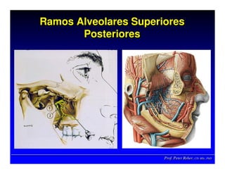 Prof. Peter Reher, CD, MSc, PhDProf. Peter Reher,Prof. Peter Reher, CD,CD, MScMSc,, PhDPhD
Ramos Alveolares Superiores
Posteriores
Ramos Alveolares SuperioresRamos Alveolares Superiores
PosterioresPosteriores
 