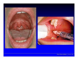 Prof. Peter Reher, CD, MSc, PhDProf. Peter Reher,Prof. Peter Reher, CD,CD, MScMSc,, PhDPhD
 