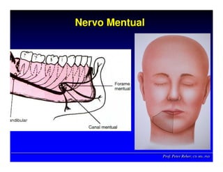 Prof. Peter Reher, CD, MSc, PhDProf. Peter Reher,Prof. Peter Reher, CD,CD, MScMSc,, PhDPhD
Nervo MentualNervoNervo MentualMentual
 