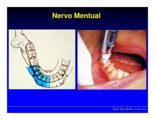 Prof. Peter Reher, CD, MSc, PhDProf. Peter Reher,Prof. Peter Reher, CD,CD, MScMSc,, PhDPhD
Nervo MentualNervoNervo MentualMentual
 