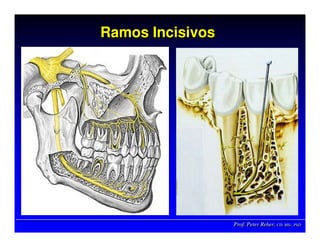 Prof. Peter Reher, CD, MSc, PhDProf. Peter Reher,Prof. Peter Reher, CD,CD, MScMSc,, PhDPhD
Ramos IncisivosRamos IncisivosRamos Incisivos
 
