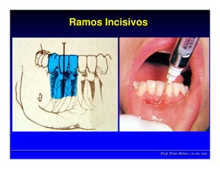 Prof. Peter Reher, CD, MSc, PhDProf. Peter Reher,Prof. Peter Reher, CD,CD, MScMSc,, PhDPhD
Ramos IncisivosRamos IncisivosRamos Incisivos
 