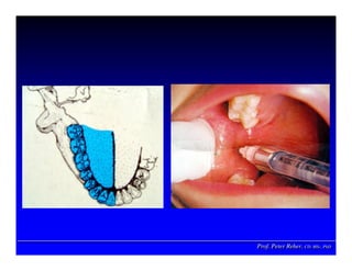 Prof. Peter Reher, CD, MSc, PhDProf. Peter Reher,Prof. Peter Reher, CD,CD, MScMSc,, PhDPhD
 