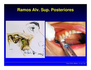 Prof. Peter Reher, CD, MSc, PhDProf. Peter Reher,Prof. Peter Reher, CD,CD, MScMSc,, PhDPhD
Ramos Alv. Sup. PosterioresRamosRamos AlvAlv.. SupSup. Posteriores. Posteriores
 
